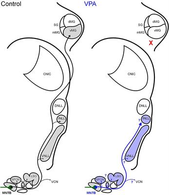 Obliteration of a glycinergic projection to the medial geniculate in an animal model of autism